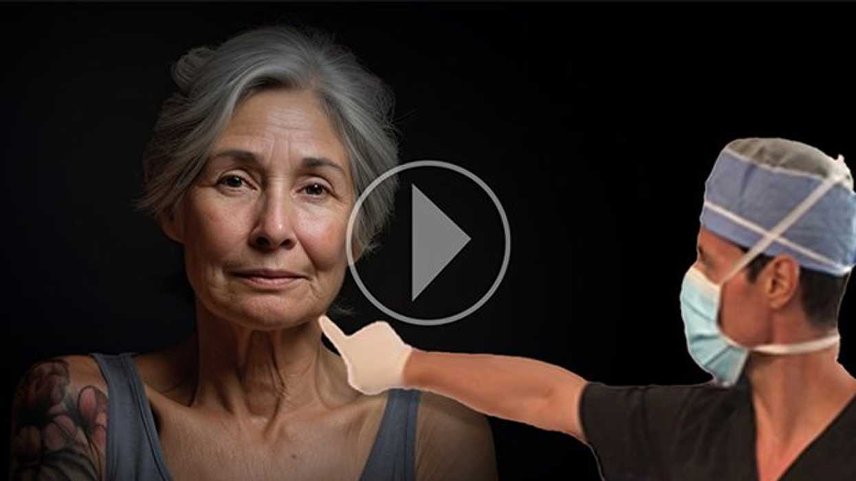 This nonsurgical jowl lift is so popular - here's why