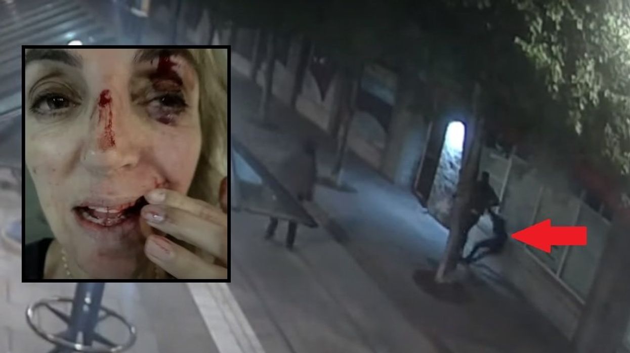 Oregon doctor blames 'defunding the police' movement after 'homeless' suspect hurls metal bottle at her head, knocking her out