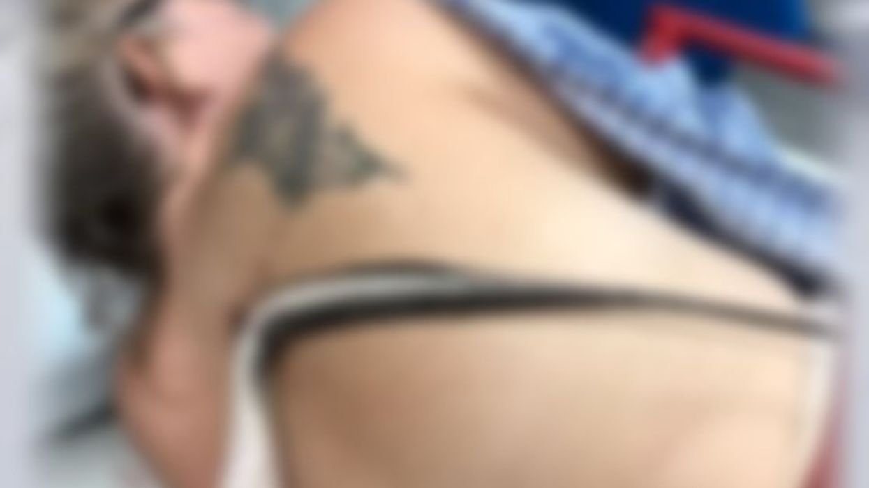 Florida woman impaled by stingray near beach, missed puncturing her lungs by an inch: 'I was certain that I was going to die'