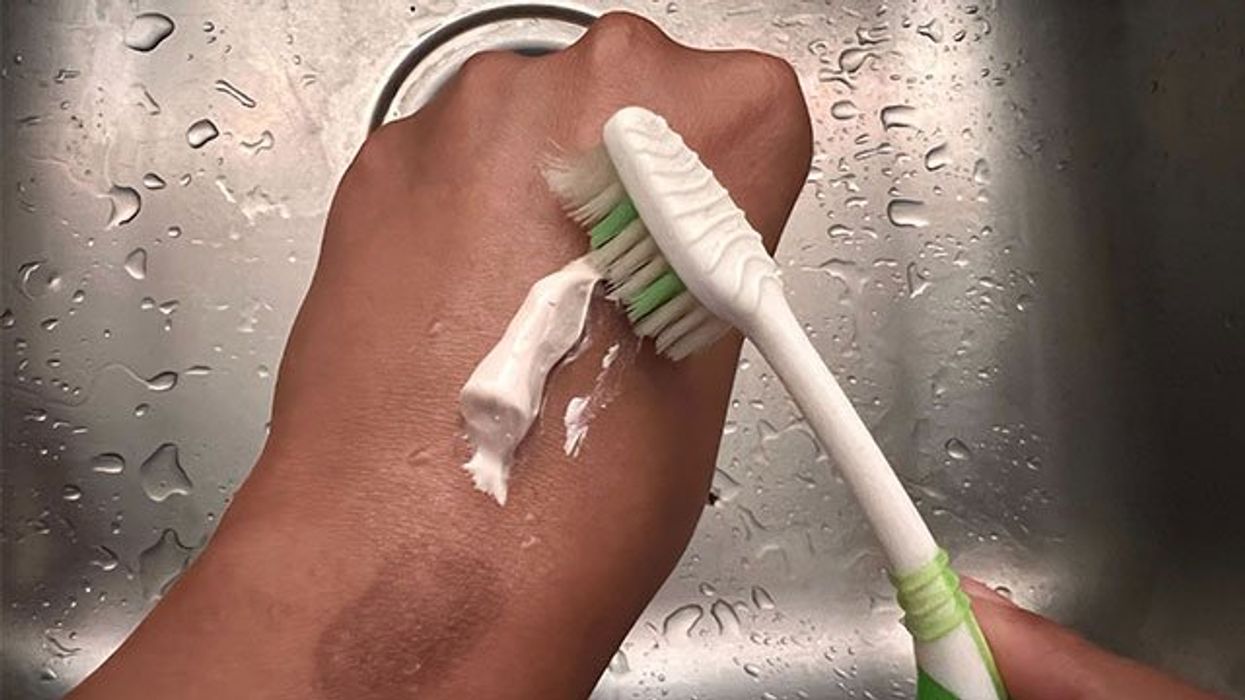 Doctor says don’t cover up your dark spots - (try this instead)