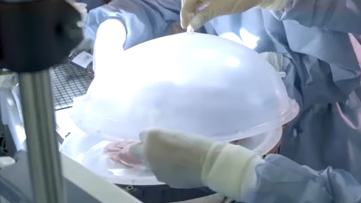 US regulators may soon approve human trials of artificial wombs
