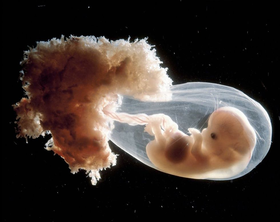 Are artificial wombs a science horror or a breakthrough? Return debates
