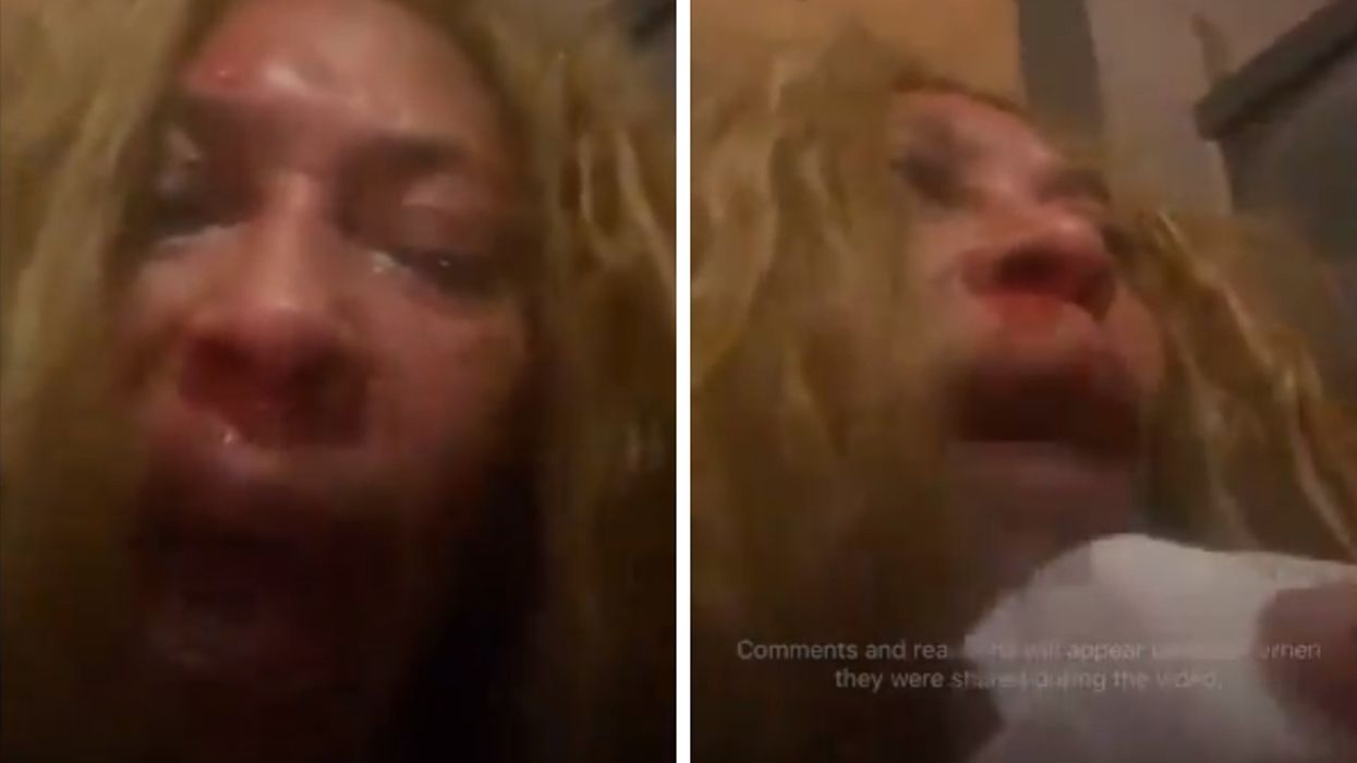 Pro-Palestinian leftists crash Democrat Christmas party, leave woman with 2 black eyes: 'Them Arabs ... tried to kill me!'