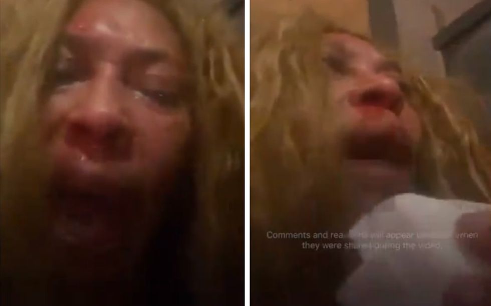 Pro-Palestinian leftists crash Democrat Christmas party‚ leave woman with 2 black eyes: 'Them Arabs ... tried to kill me!'