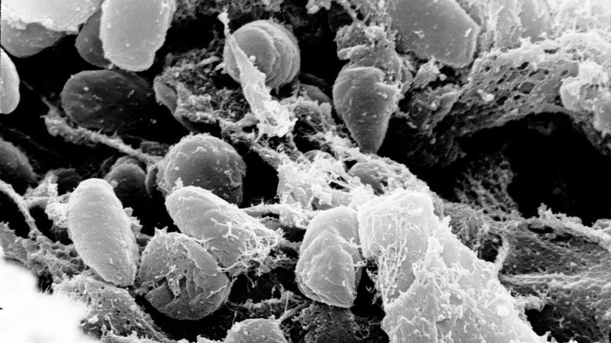 Oregon officials confirm first bubonic plague case in the state since 2015