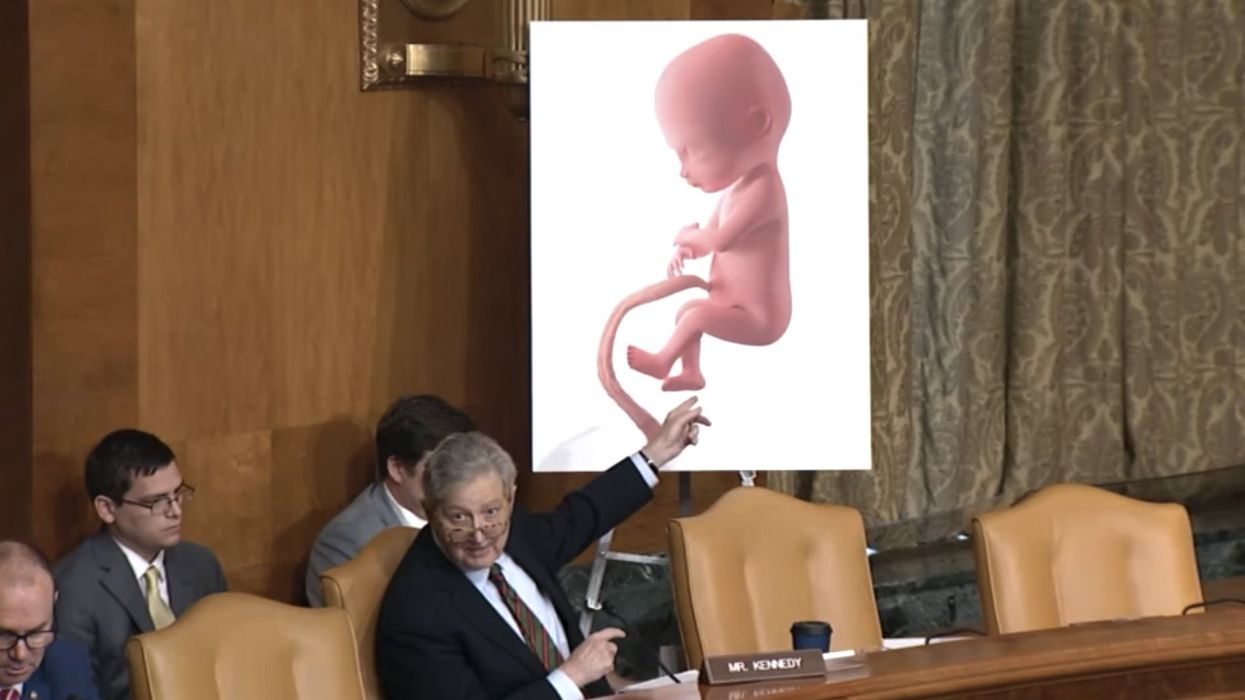Sen. Kennedy reads horrors of the abortion procedure into Senate record, but uncomfortable Democrat cuts him off