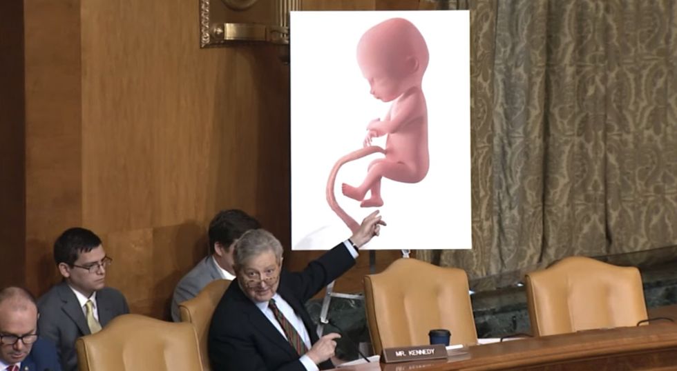 Sen. Kennedy reads horrors of the abortion procedure into Senate record‚ but uncomfortable Democrat cuts him off