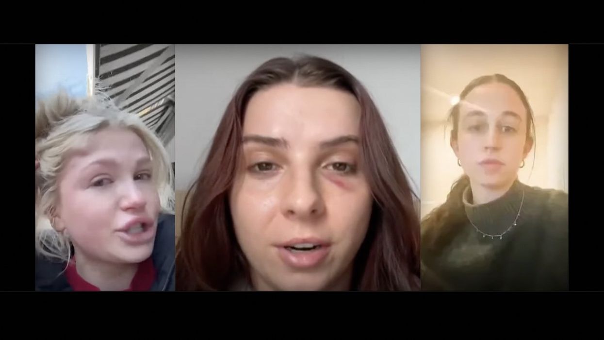 Horrified women say men punched them in face, head in unprovoked, broad-daylight attacks on NYC streets this month