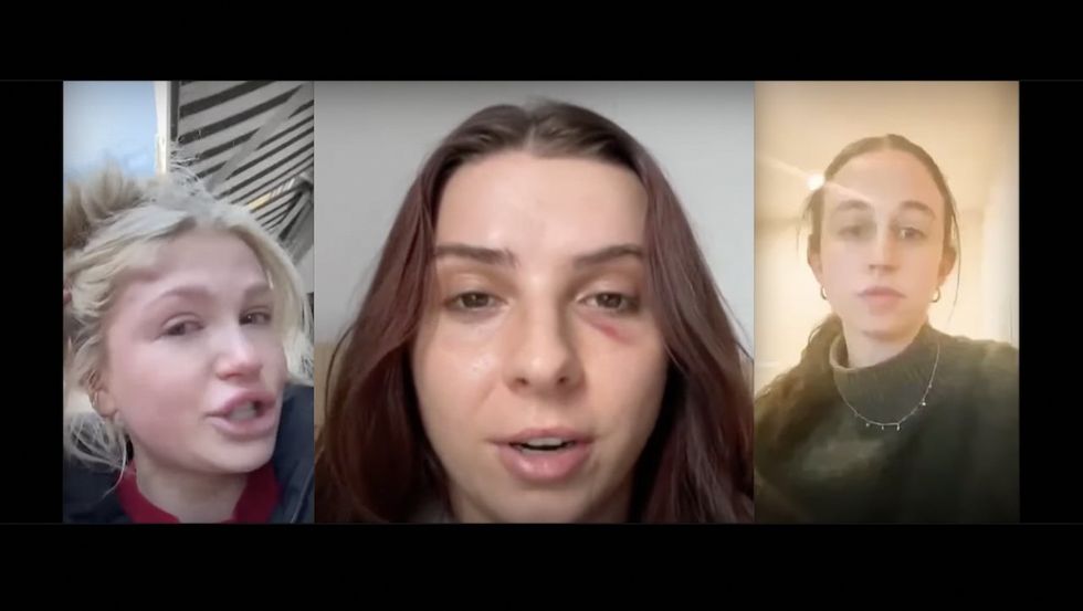 Horrified women say men punched them in face‚ head in unprovoked‚ broad-daylight attacks on NYC streets this month