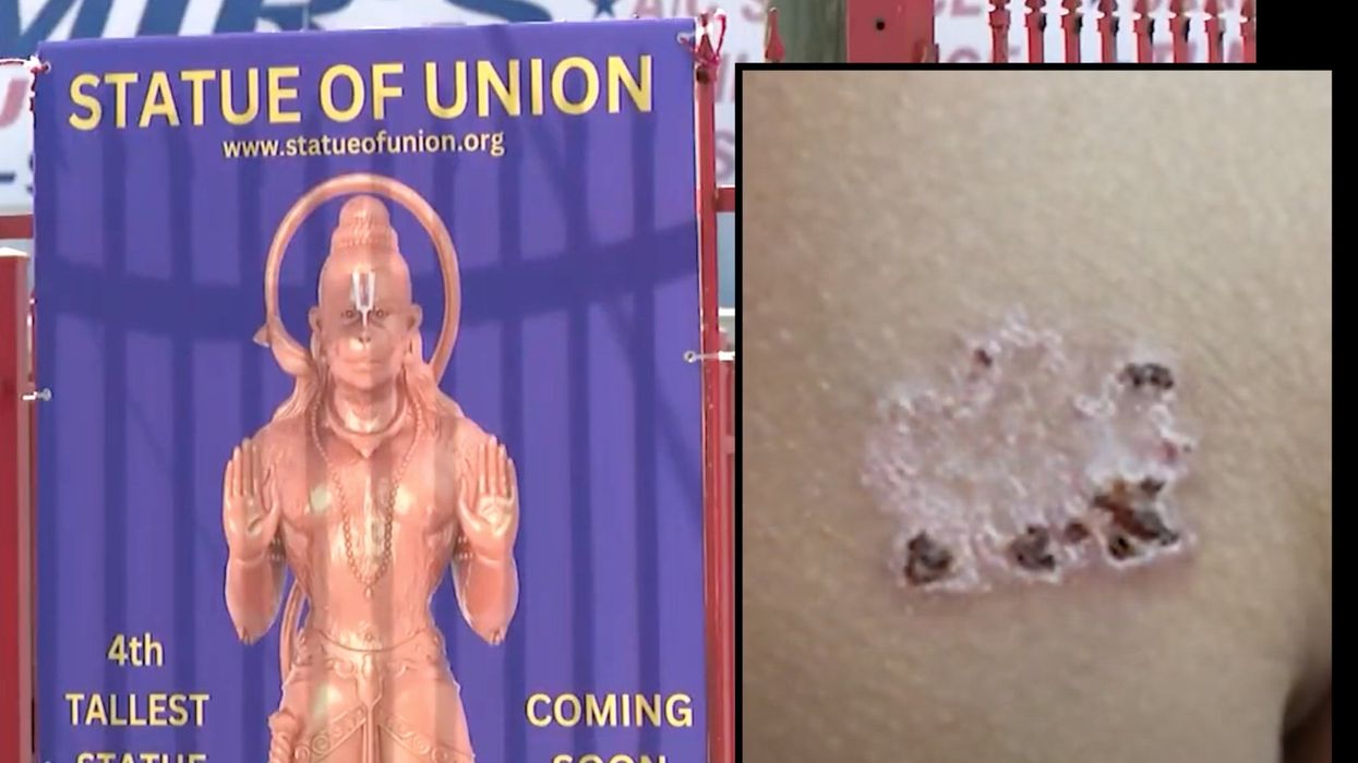 Father says 11-year-old son was branded with hot iron in religious ceremony at Hindu temple in Texas without his approval