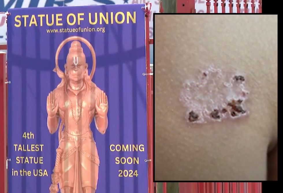 Father says 11-year-old son was branded with hot iron in religious ceremony at Hindu temple in Texas without his approval