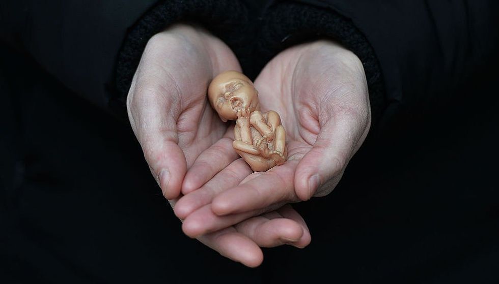 Poll finds a shocking number of Catholics believe abortion should be legalized — and the trend is only getting worse