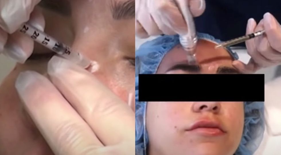 As many as 59 women were exposed to HIV infection over &apos;vampire facials&apos; and Botox injections‚ health officials say