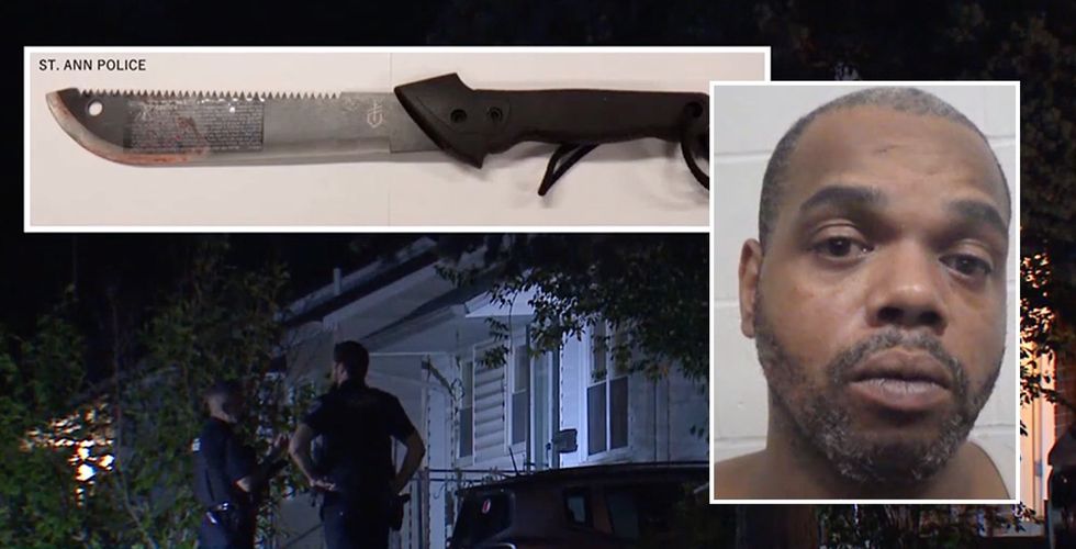 Missouri man slashes woman&apos;s face with machete‚ according to police