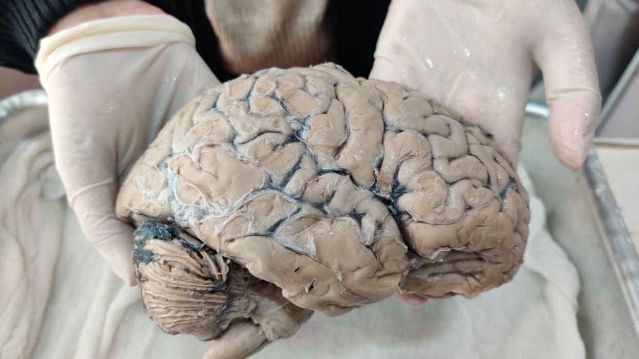 Researchers make a pivotal discovery for the future of brain-like computing by using an 'iontronic memristor'