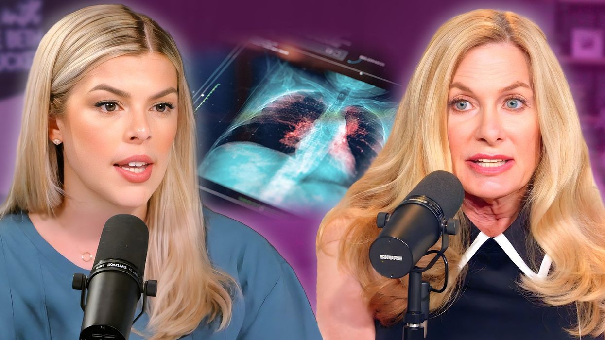 Cancer patients are younger than ever — and this doctor knows why