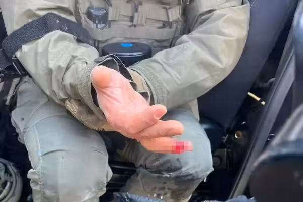 Rioter bit off part of federal agent's finger amid Minneapolis 'rampant assault,' DHS says