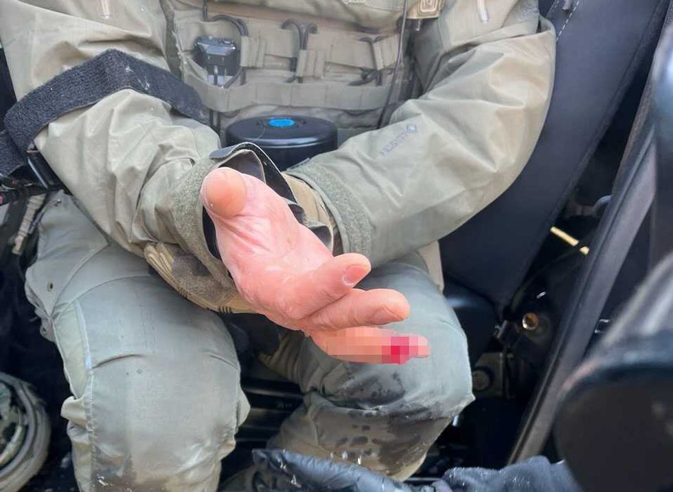 Rioter bit off part of federal agent's finger amid Minneapolis 'rampant assault,' DHS says