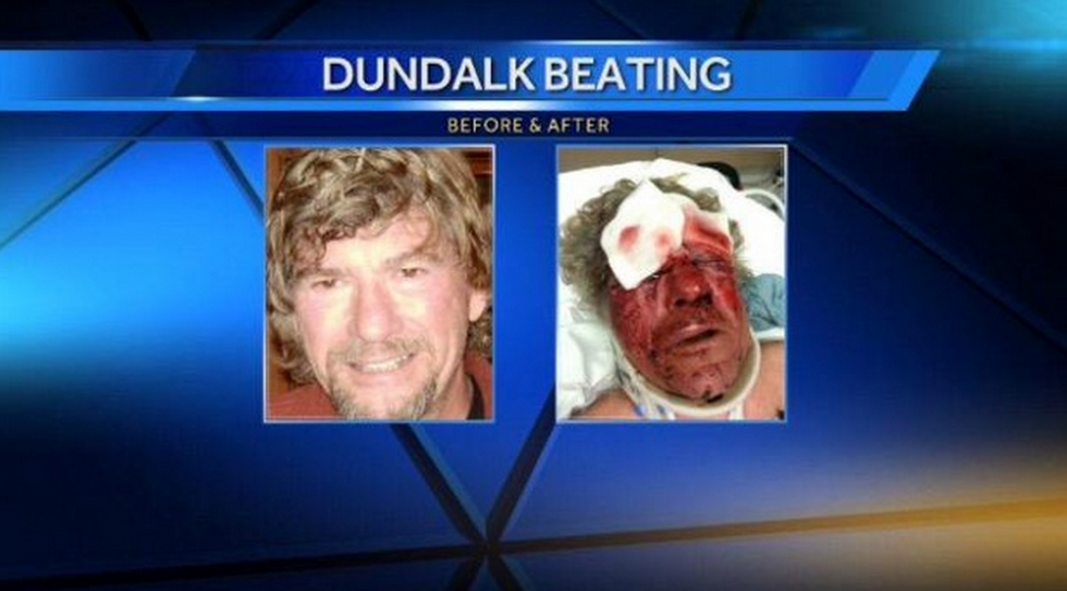 Second Arrest Made in Savage Beating of Man Near Baltimore; Stomach-Turning Video and Images Emerge