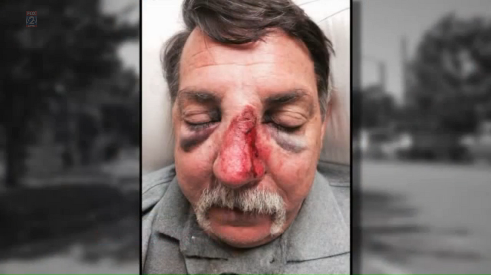 He Called 911 After Being Assaulted in Road Rage Incident — Cops' Alleged Response Baffled Him…Until He Learned This