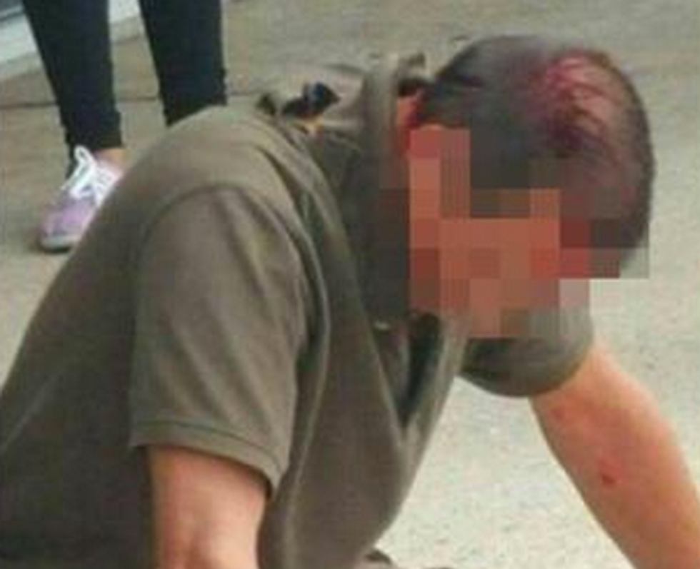 Pistol-Whipped Officer Mocked in Viral Photo Breaks Silence, Reveals Distressing Reason He Didn't Use Force on Suspect