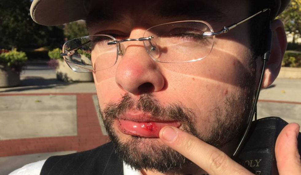 VIDEO: Christian Preacher Punched in the Mouth Inside Mizzou 'Free Speech Zone