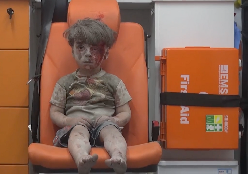 New Viral Photo of Wounded 5-Year-Old Boy Offers Glimpse Into the Horrors Plaguing Aleppo
