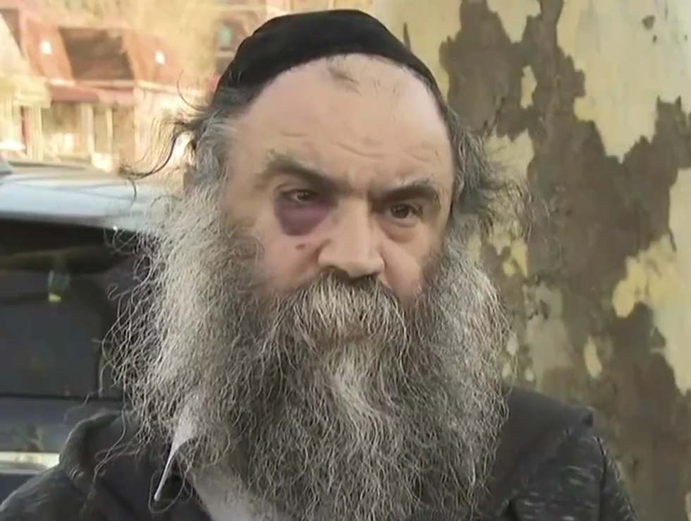 Orthodox Jew rescued from anti-Semitic attacker by 'good Samaritan' nurses