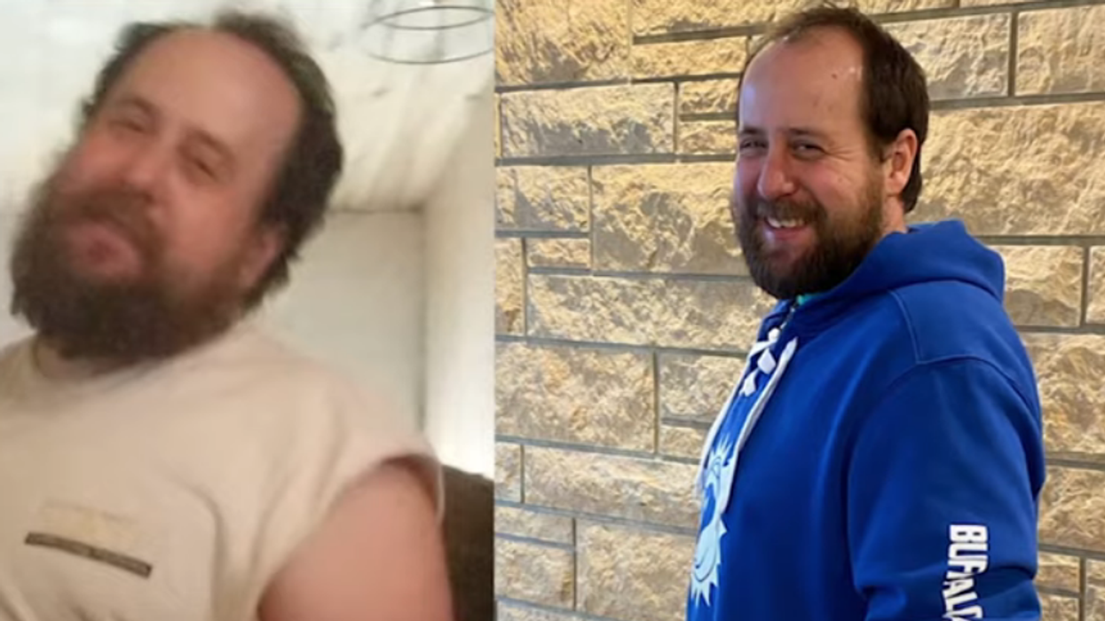 This dad lost 40 pounds so he could donate his liver to save his 1-year-old son