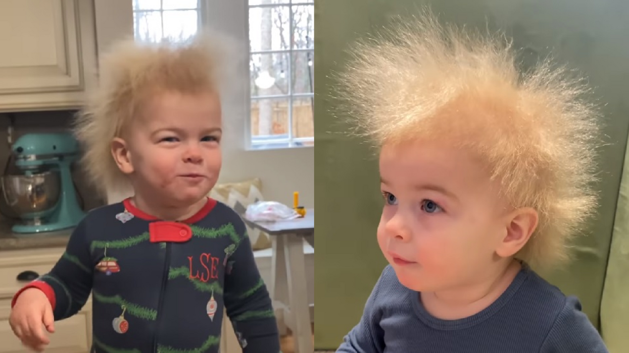 Mom shocked to find out 'Uncombable Hair Syndrome' is a real thing