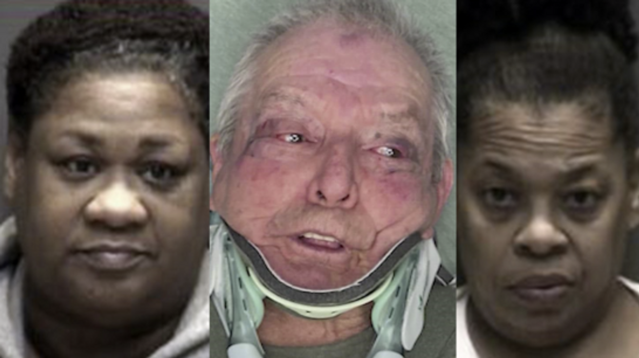 Video exposes nursing home workers abusing 87-year-old amputee man