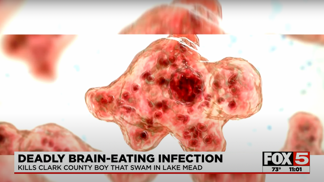Rare brain-eating amoeba infection kills boy