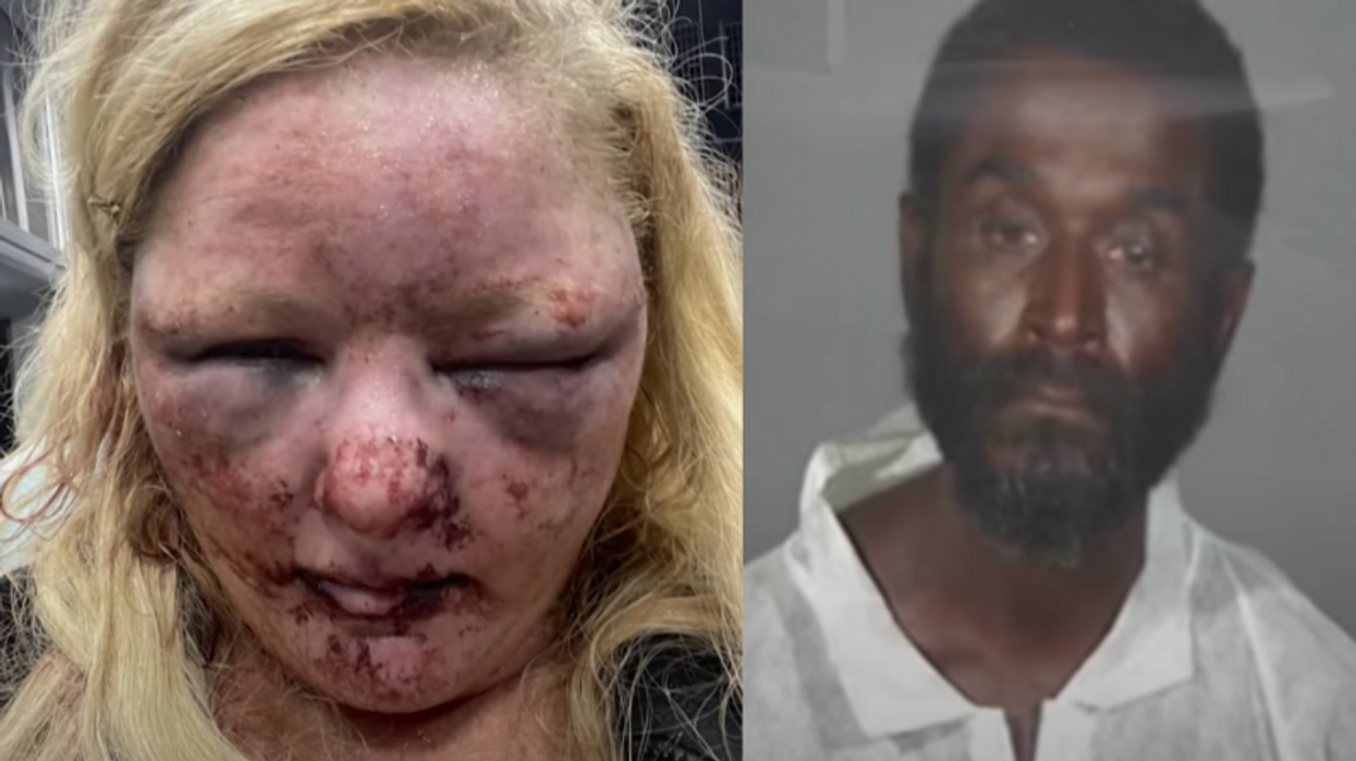 While walking her dogs, LA woman was brutally raped by suspect released from jail hours earlier – survivor recalls trying to bite off attacker's penis