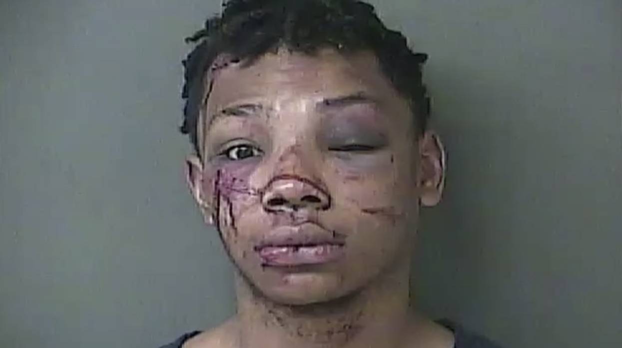 Armed would-be robber gets his face rearranged after apartment residents turn the table and use his own guns against him