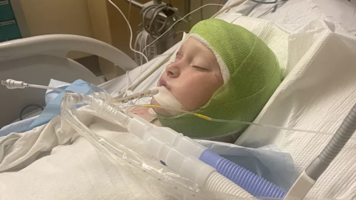 'Blood everywhere': 11-year-old viciously mauled by pit bulls while riding bike, dogs tear off boy's ear and 80% of his scalp