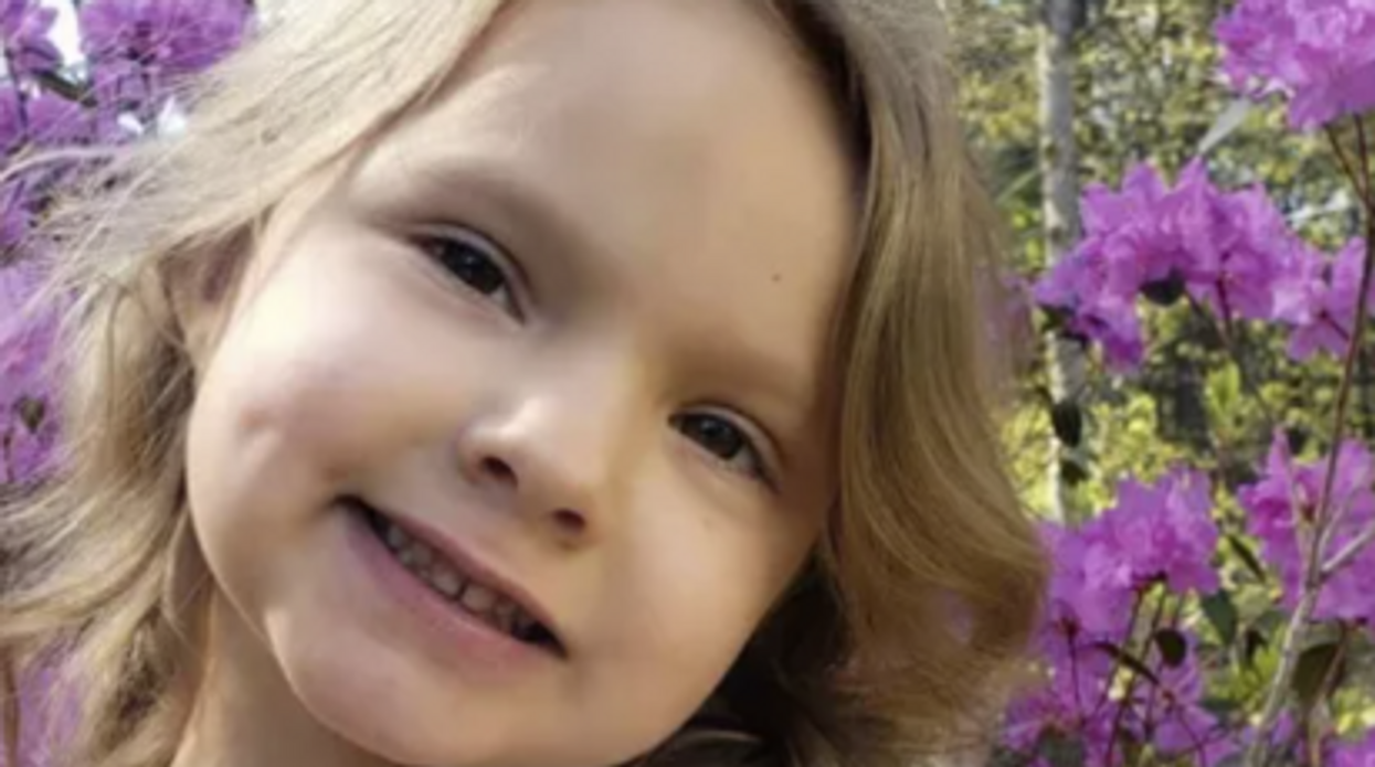 6-year-old girl may never smile again after needing 1,000 stitches from being mauled in pit bull attack