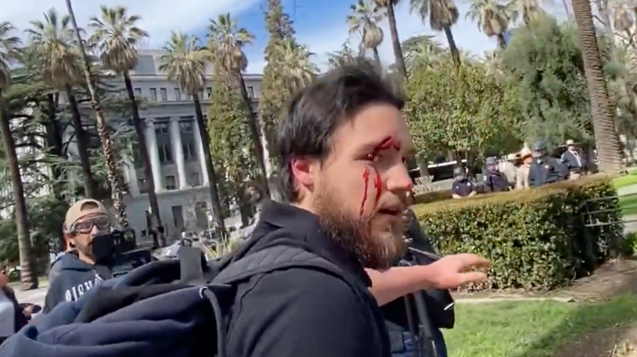 VIDEO: Reporter, cameraman allegedly attacked by 'militant anarchists' in 'black bloc' at Chloe Cole's detransition awareness rally