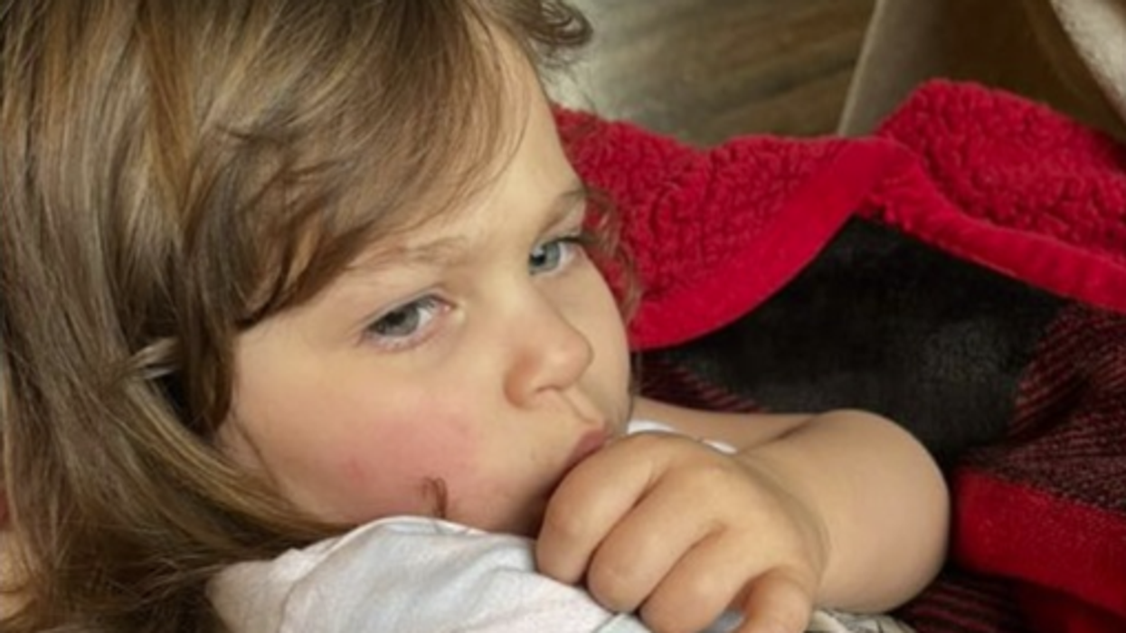 3-year-old Louisiana girl may never smile again after being mauled by foster dog that ate toddler's face: 'She was being thrown all over the place'