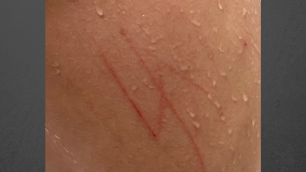 Jewish boy with autism returned from school with swastika carved into his skin, mother says; FBI 'prepared to investigate'