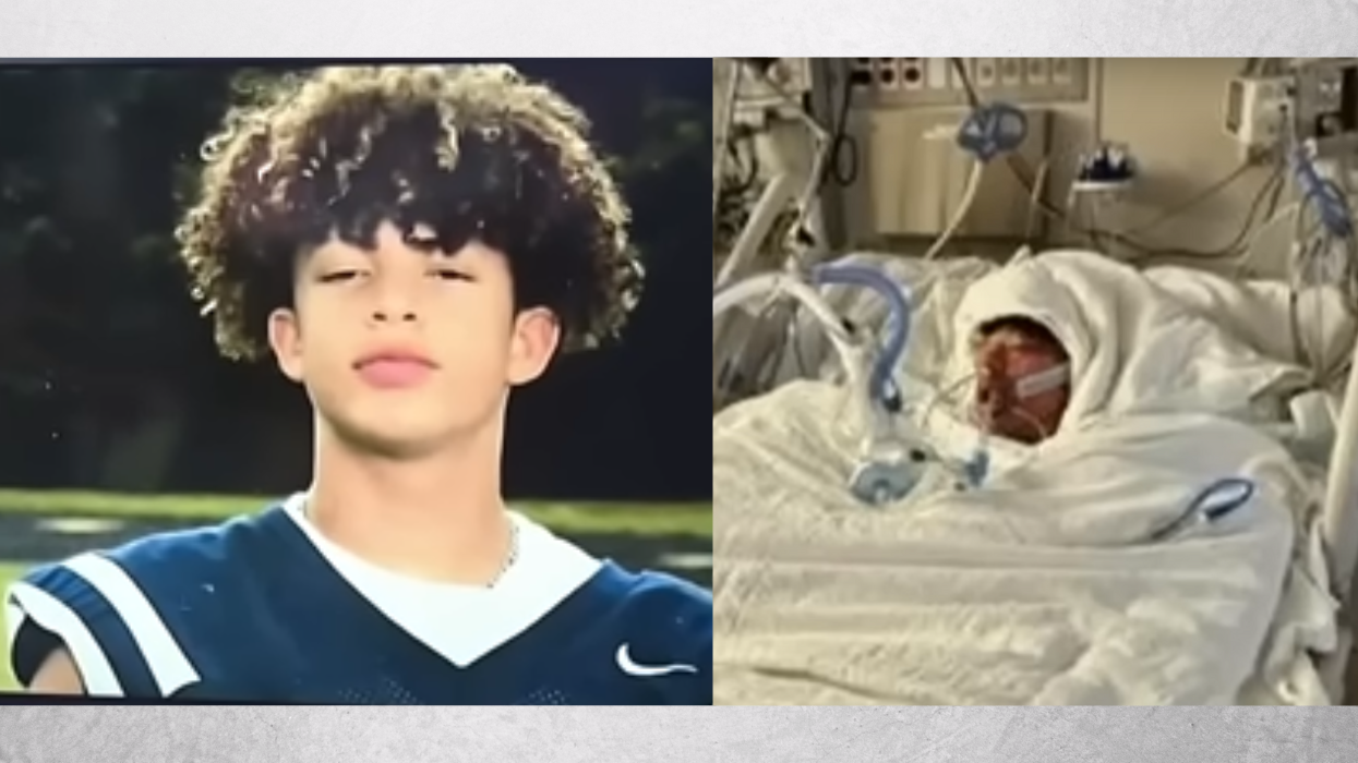 'Unrecognizable': Boy burned over 76% of his body after dangerous TikTok challenge