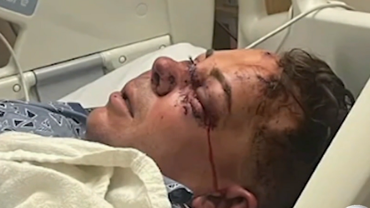 'They almost killed him': Store owner's skull fractured, his blood smeared across floor after armed robbers brutally beat him