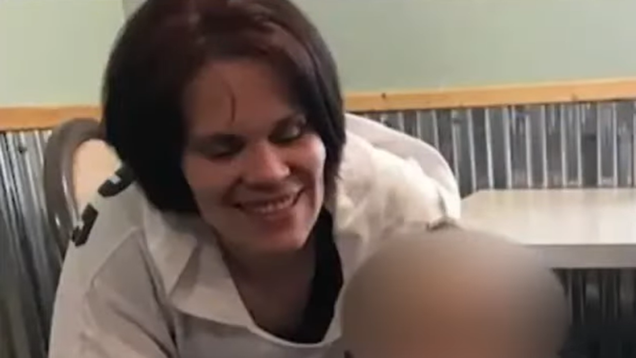 Iowa mother loses legs, needs facial reconstructive surgery after attack by 3 pit bulls, officer shoots dogs dead