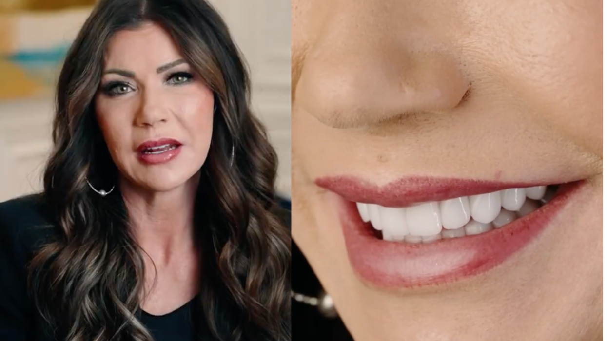 South Dakota Gov. Kristi Noem raises eyebrows by posting video about having dental work done by Smile Texas