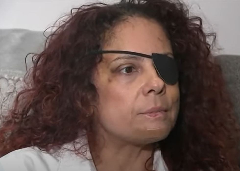 American woman reportedly brutally beaten by growling‚ 'pure evil‚' fake taxi driver on Caribbean island: 'I fought for my life'