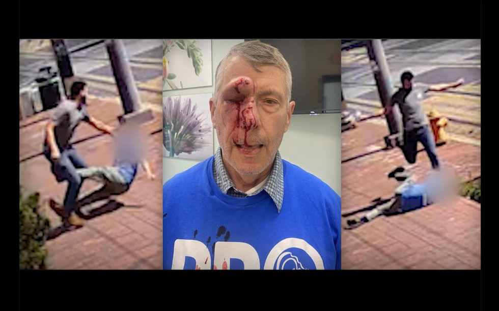 Justice for elderly pro-lifer beaten to a pulp outside Planned Parenthood takes brutal turn