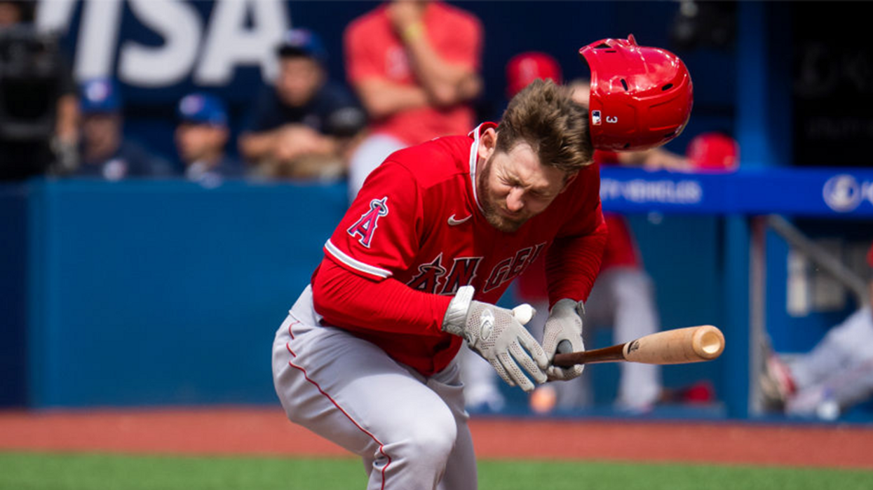 LA Angels star suffers facial fractures from 92mph pitch to the eye