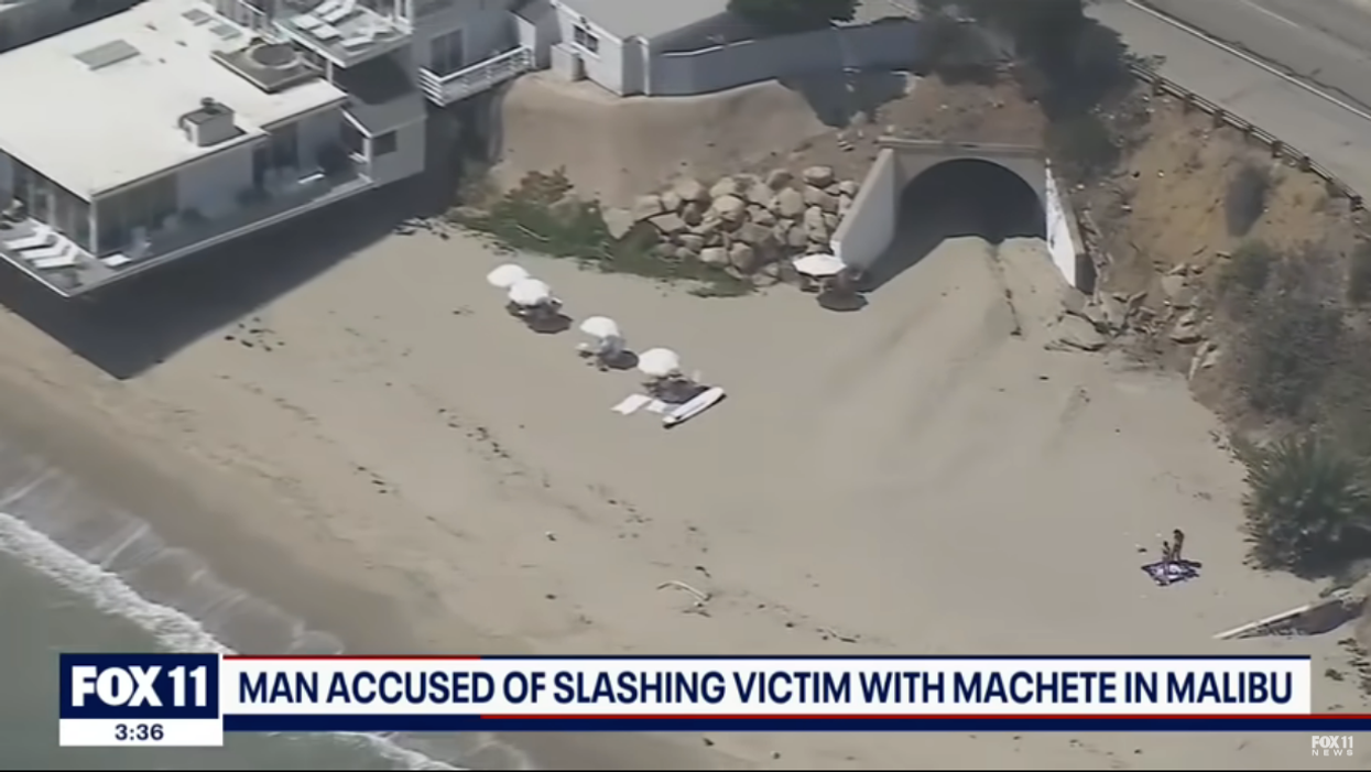 Malibu homeless man reportedly attacks family of 5 with machete, causes dad to lose an eye. Suspect was arrested months earlier but released by progressive DA.