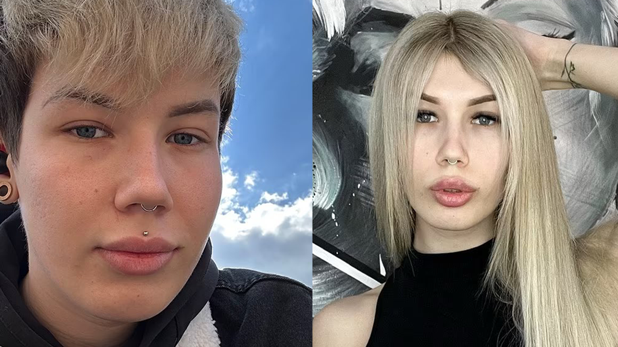 Man de-transitions, says transgender surgery should be banned: 'The surgery destroyed my life'