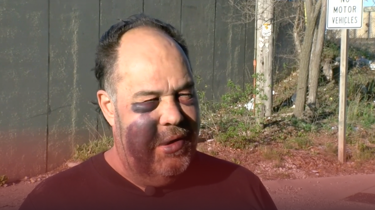 Man pays dearly after confronting gang of motorcyclists illegally riding path behind his home: 'I was ... knocked out'