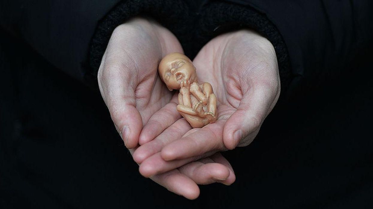 Mother, daughter charged in horrific illegal abortion case. But the media mislead to push pro-abortion angle.
